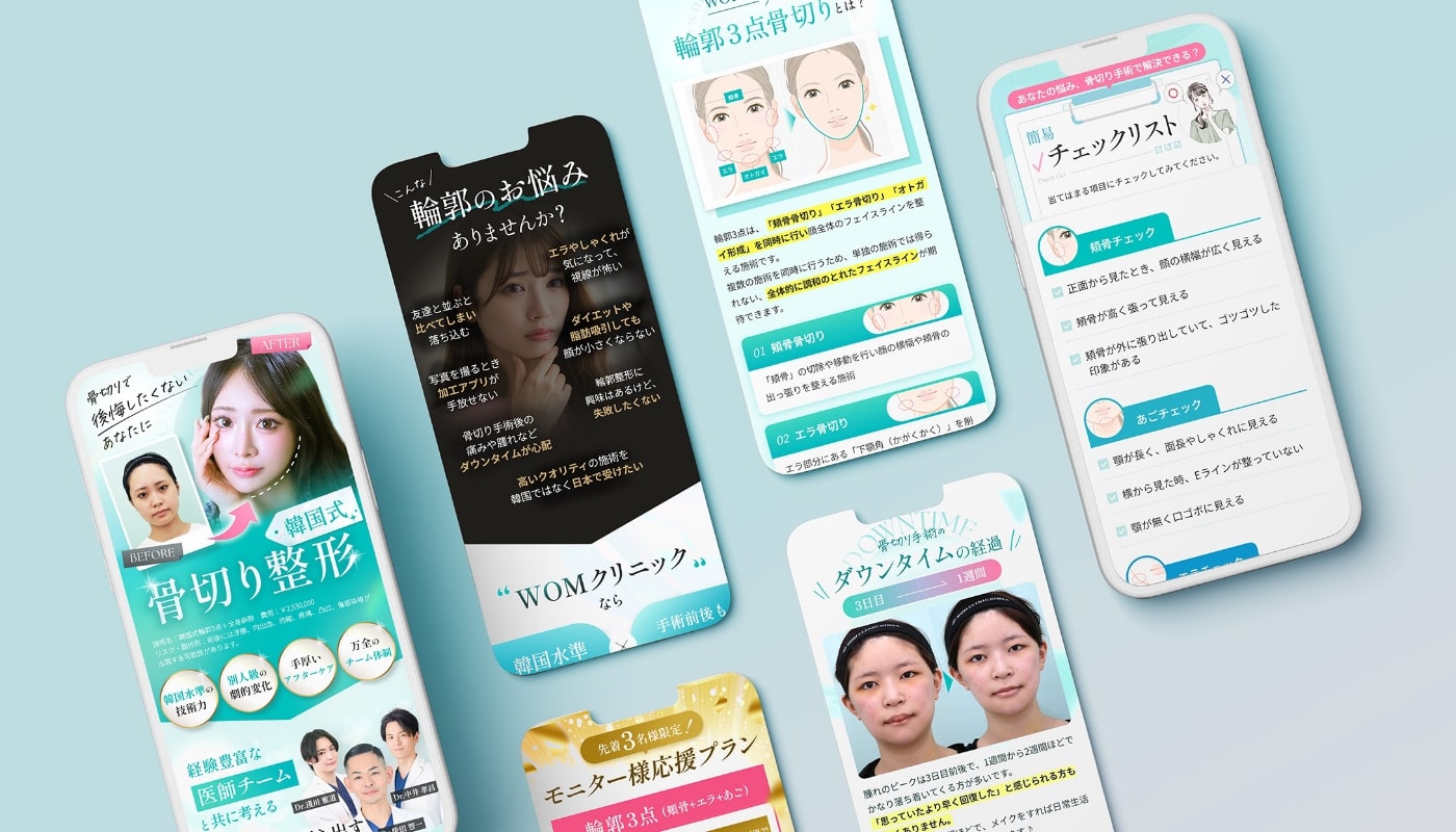 骨切り整形で理想の輪郭へ｜韓国式小顔整形のWOMクリニック銀座