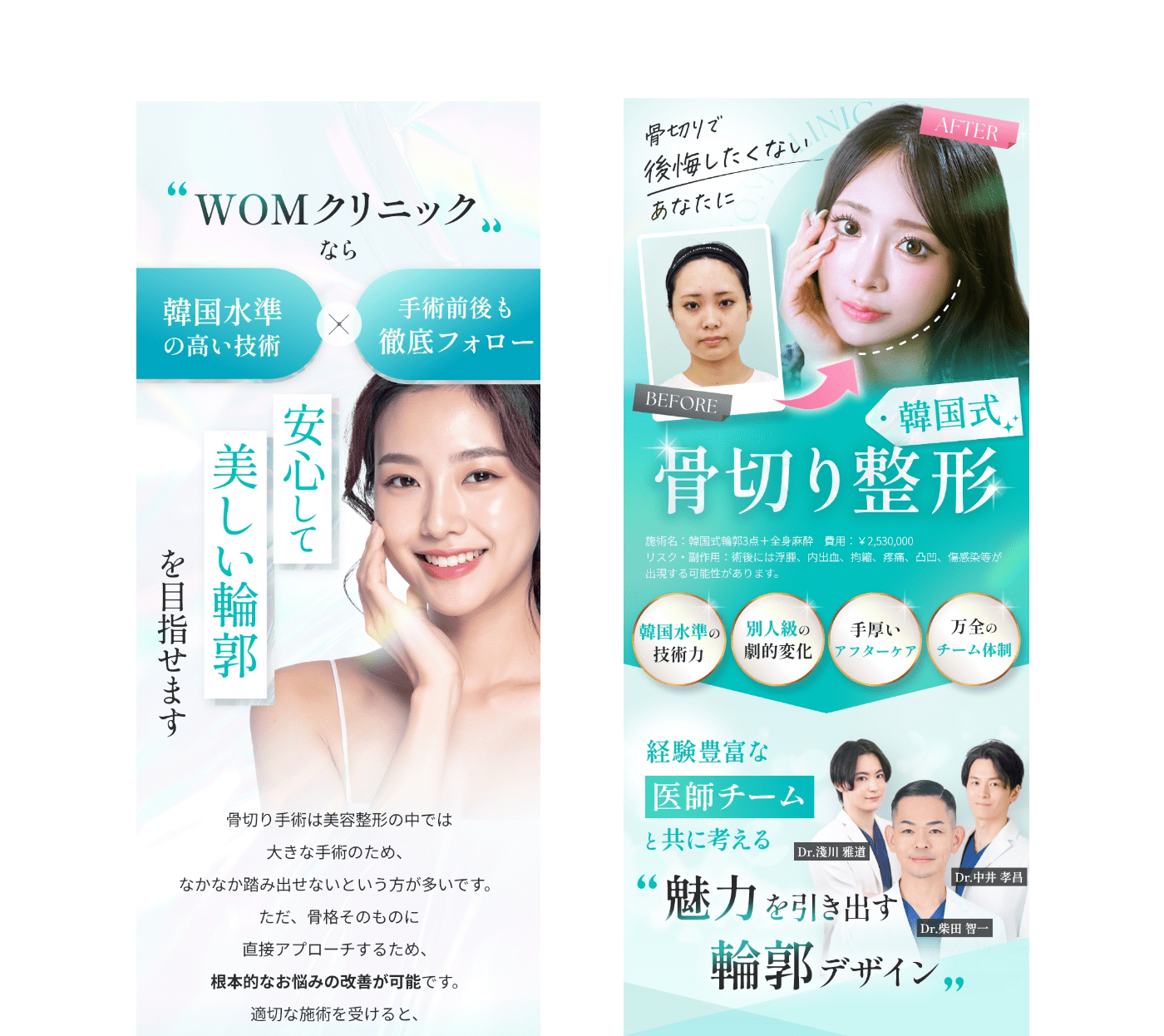 骨切り整形で理想の輪郭へ｜韓国式小顔整形のWOMクリニック銀座