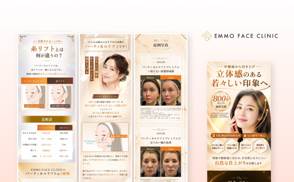 EMMO FACE CLINICのバーティカルリフトLP